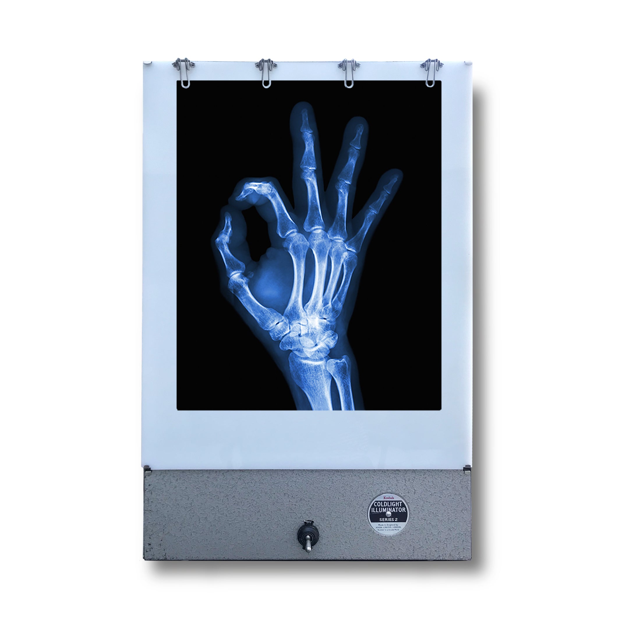 Vintage Kodak X Ray Lightbox
